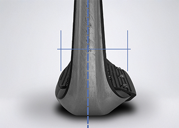 Centre de gravité décalé